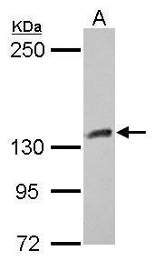 Anti-CYFIP1 antibody [N1N2], N-term used in Western blot. GTX122467