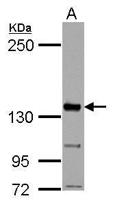 Anti-CYFIP1 antibody [N1N2], N-term used in Western blot. GTX122467