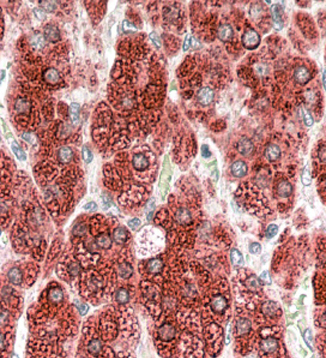 Anti-CYP17A1 antibody, Internal used in IHC (Formalin-fixed paraffin-embedded sections). GTX89365