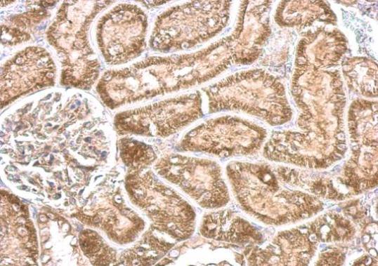 Anti-CYP24A1 antibody used in IHC (Formalin-fixed paraffin-embedded sections). GTX105884