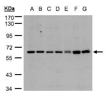Anti-CYP24A1 antibody used in Western blot. GTX105884