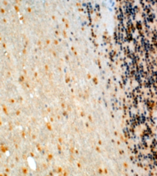 Anti-CYP26B1 antibody, Internal used in IHC (Formalin-fixed paraffin-embedded sections). GTX89224