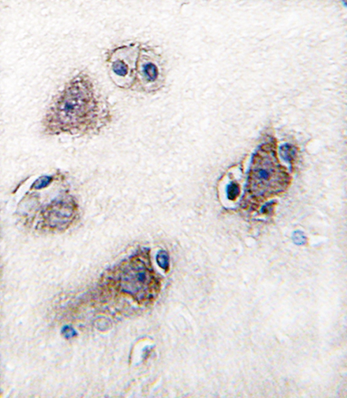 Anti-CYP26C1 antibody, C-term used in IHC (Formalin-fixed paraffin-embedded sections). GTX81246