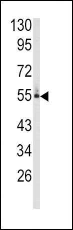 Anti-CYP26C1 antibody, C-term used in Western blot. GTX81246