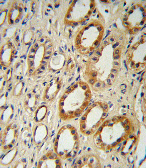 Anti-CYP27B1 antibody, C-term used in IHC (Formalin-fixed paraffin-embedded sections). GTX80588