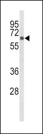 Anti-CYP27B1 antibody, C-term used in Western blot. GTX80588