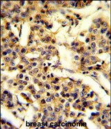 Anti-CYP2A13 antibody, C-term used in IHC (Formalin-fixed paraffin-embedded sections). GTX81118