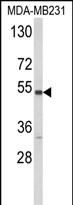 Anti-CYP2A13 antibody, C-term used in Western blot. GTX81118