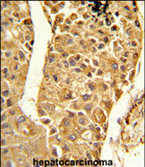 Anti-CYP2C18 antibody, C-term used in IHC (Formalin-fixed paraffin-embedded sections). GTX81067