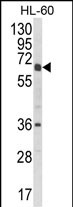 Anti-CYP2C18 antibody, C-term used in Western blot. GTX81067