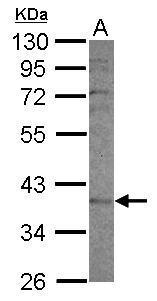 Anti-CYP2F1 antibody [N1C1] used in Western blot. GTX117184