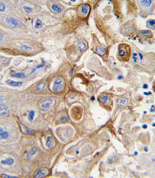 Anti-CYP2W1 antibody, N-term used in IHC (Formalin-fixed paraffin-embedded sections). GTX81289
