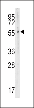Anti-CYP2W1 antibody, N-term used in Western blot. GTX81289