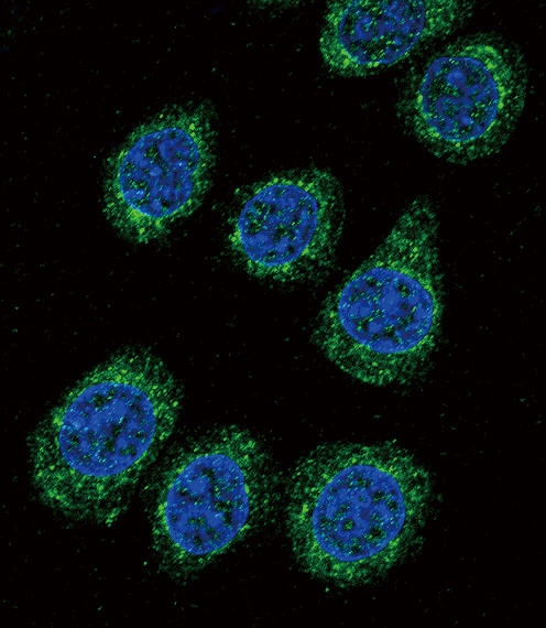 Anti-CYP3A5 antibody, C-term used in ICC/IF. GTX81287