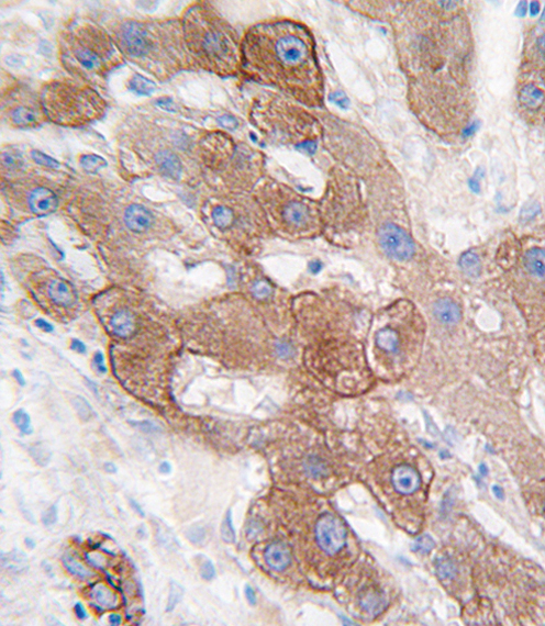 Anti-CYP3A5 antibody, C-term used in IHC (Formalin-fixed paraffin-embedded sections). GTX81287