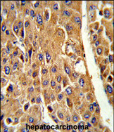 Anti-CYP3A5 antibody, Internal used in IHC (Formalin-fixed paraffin-embedded sections). GTX81286