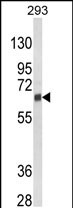 Anti-CYP3A5 antibody, Internal used in Western blot. GTX81286