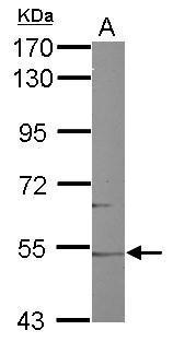 Anti-CYP46A1 antibody [N1C2] used in Western blot. GTX105183