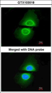 Anti-CYP4A11 antibody [N1C1] used in ICC/IF. GTX103518