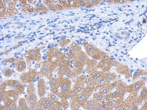 Anti-CYP4A11 antibody [N3C3] used in IHC (Formalin-fixed paraffin-embedded sections). GTX114353