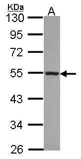 Anti-CYP4A11 antibody [N3C3] used in Western blot. GTX114353