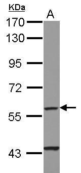 Anti-CYP4F11 antibody [N1N3] used in Western blot. GTX116701