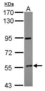 Anti-CYP4F12 antibody used in Western blot. GTX104951