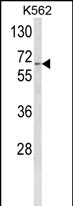 Anti-CYP4F3 antibody, N-term used in Western blot. GTX81119