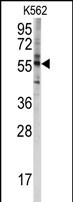 Anti-CYP4F8 antibody, C-term used in Western blot. GTX81247