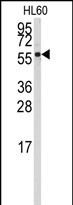 Anti-CYP4Z1 antibody, N-term used in Western blot. GTX81250