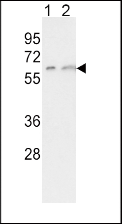 Anti-CYP7A1 antibody, C-term used in Western blot. GTX81230