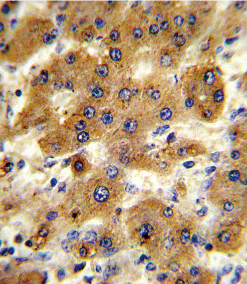 Anti-CYP8B1 antibody, C-term used in IHC (Formalin-fixed paraffin-embedded sections). GTX81025