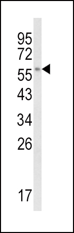 Anti-CYP8B1 antibody, C-term used in Western blot. GTX81025