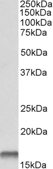 Anti-Cystatin B antibody, C-term used in Western blot. GTX15970
