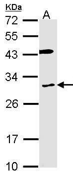 Anti-Cytochrome b reductase 1 antibody [C2C3], C-term used in Western blot. GTX104793