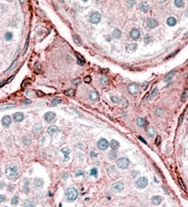 Anti-Cytochrome b reductase 1 antibody, C-term used in IHC (Formalin-fixed paraffin-embedded sections). GTX89592