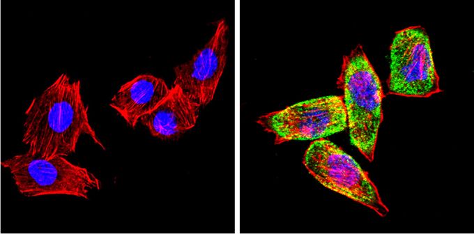 Anti-Cytochrome P450 2C11 antibody used in ICC/IF. GTX79174