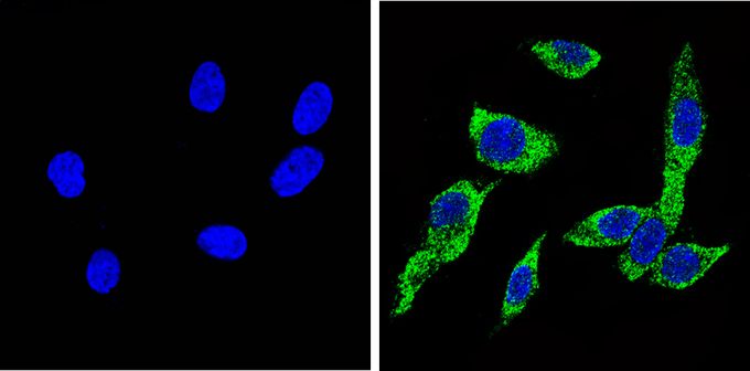Anti-Cytochrome P450 2C11 antibody used in ICC/IF. GTX79174