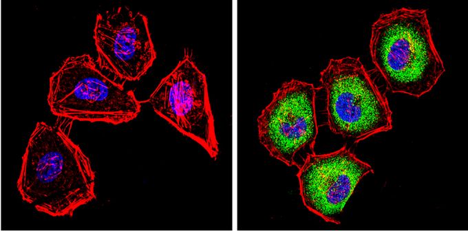 Anti-Cytochrome P450 2C11 antibody used in ICC/IF. GTX79174