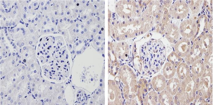 Anti-Cytochrome P450 2C11 antibody used in IHC (Formalin-fixed paraffin-embedded sections). GTX79174