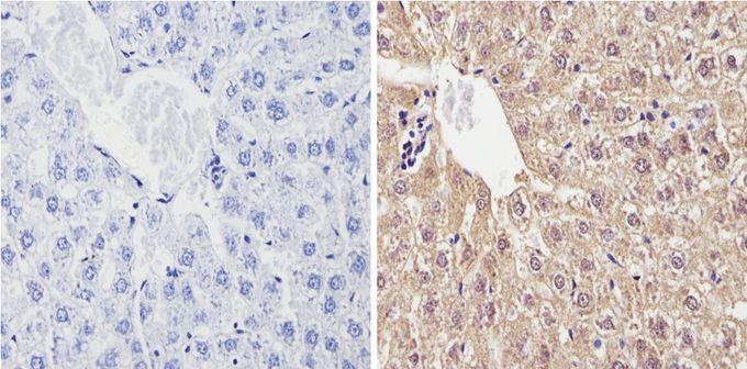 Anti-Cytochrome P450 2C11 antibody used in IHC (Formalin-fixed paraffin-embedded sections). GTX79174