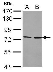 Anti-Cytochrome P450 4F2 antibody [N2C2], Internal used in Western blot. GTX102722