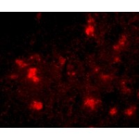 Anti-Dact2 antibody used in ICC/IF. GTX85373
