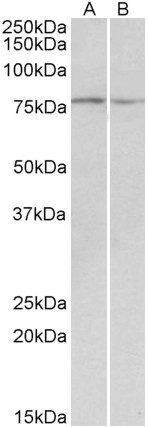Anti-DAG1 antibody, Internal used in Western blot. GTX88089