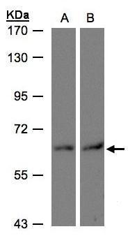 Anti-DAK antibody used in Western blot. GTX103102