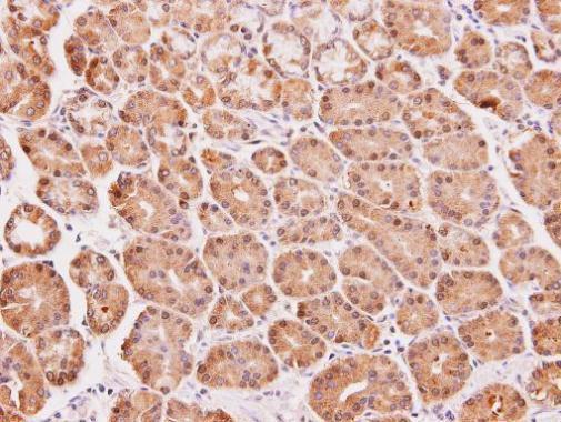 Anti-DAK antibody used in IHC (Formalin-fixed paraffin-embedded sections). GTX103102