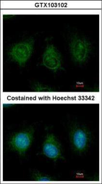 Anti-DAK antibody used in ICC/IF. GTX103102