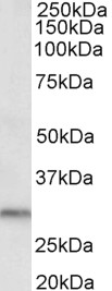 Anti-DAPP1 antibody, C-term used in Western blot. GTX89948