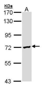 Anti-DAZ2 antibody [N1N3] used in Western blot. GTX109981