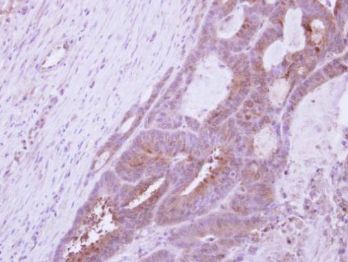 Anti-DAZ3 antibody used in IHC (Formalin-fixed paraffin-embedded sections). GTX106859